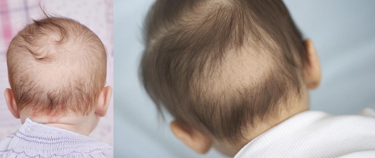 Ребенок родился с черными волосами при том что у родителей волосы русые