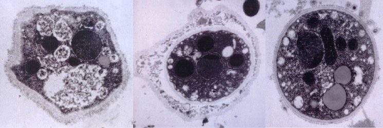 Бластоцисты в кале лечение. Бластоциста хоминис. Бластоцисты (Blastocystis SPP.). Бластоциста гистология.