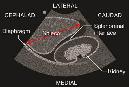measurement-of-the-spleen